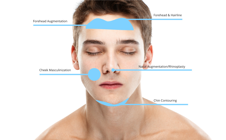 face masculinization