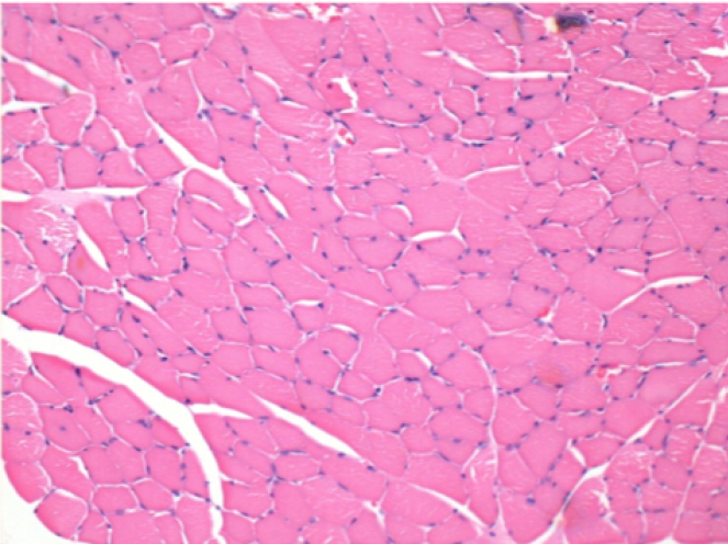 left control- 100xD10