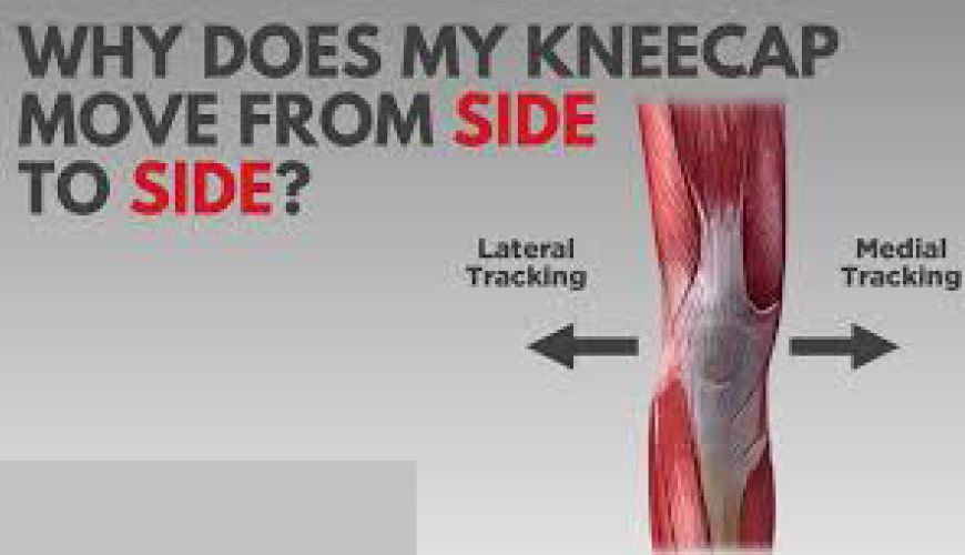 knee instability