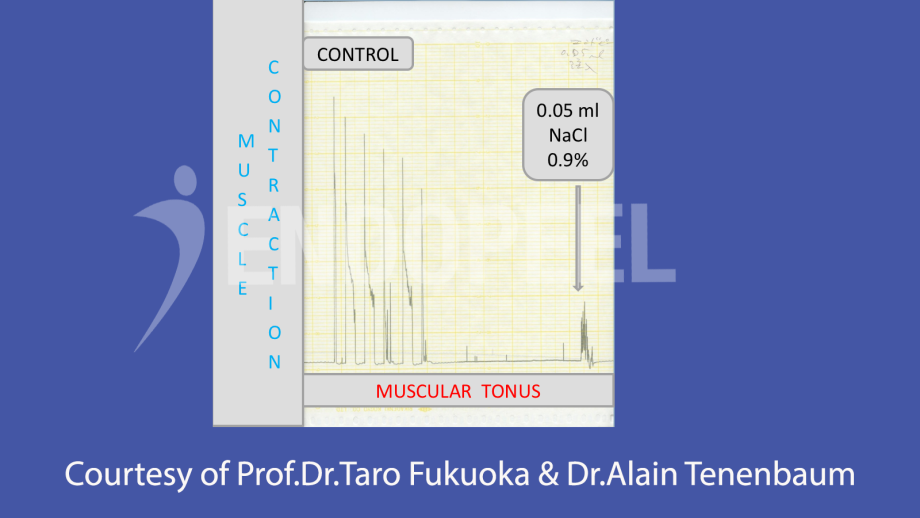 Muscle Contraction and Muscular Tonus Control